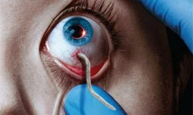 Gözünü qurd basmış qadın xilas edildi