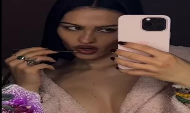 Modeldən qəribə addım - Elə yerinə botoks etdirdi ki... - FOTOlar