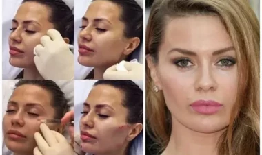 Dəfələrlə plastik əməliyyat etdirən məşhur model tanınmaz halda - FOTO