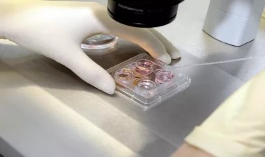 Azərbaycanda İİV-ə yoluxanların sayı nə qədərdir?