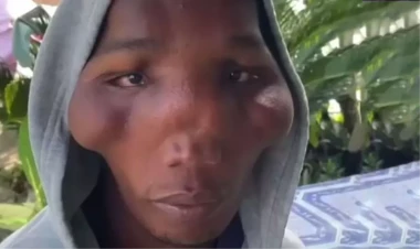 Bu ailənin xəstəliyinin çarəsi tapılmır - üçbucaq baş... - FOTOlar