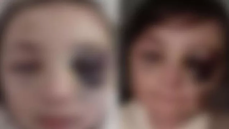 Şagirdin məktəbdə xəsarət alması ilə bağlı rəsmi açıqlama