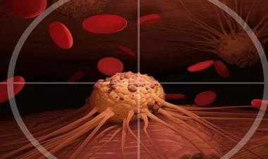 Xərçəngin çarəsi tapıldı