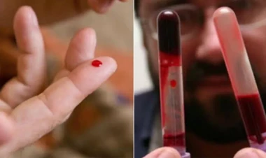 Qanı qatılaşdıran qidalar və içkilər