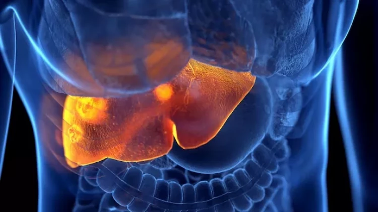 Qaraciyərdəki artıq piylərdən qurtulmağın YOLU TAPILDI