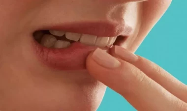 Dodaq çeynəmə vərdişinin ölümcül təhlükəsi açıqlandı