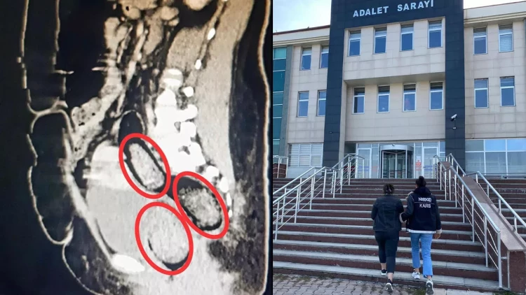 Narkotiki görün harada gizlədib - polislər mat qaldı - FOTOlar