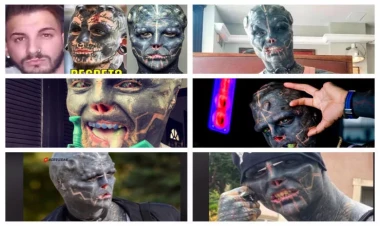 Yadplanetliyə oxşamaq üçün dəfələrlə əməliyyat etdirdi - FOTO