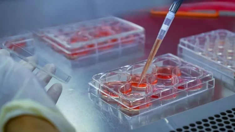 Bunu da bacardılar: xərçəngin müalicəsində ƏN SON yenilik