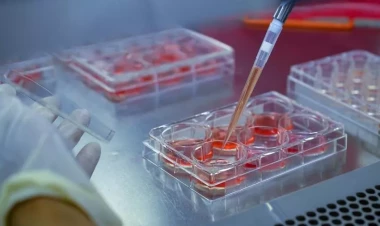 Bunu da bacardılar: xərçəngin müalicəsində ƏN SON yenilik