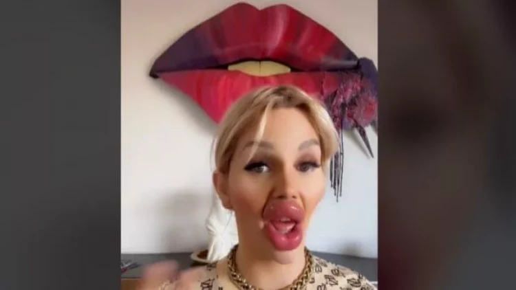 Yemək yeməyinə mane olur və üzünün yarısını tutur - FOTO