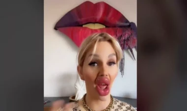 Yemək yeməyinə mane olur və üzünün yarısını tutur - FOTO