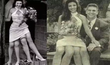 Əkiz bacısının bətnindən hamilə qalan 4 ayaqlı qadın - FOTO