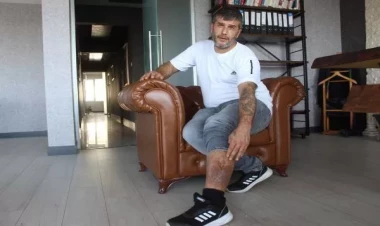 Ayağı ağrıyır deyə həkimə getdi, şoka düşdü - 16 il əvvəl ... - VİDEO