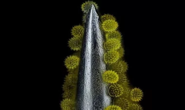 Dünya iynənin ucunda: Mikrofotoqrafiya müsabiqəsinin qalibləri açıqlandı - FOTOlar