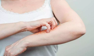 Əli və ayağı qaşınanlar – Qaraciyərini yoxlatsın