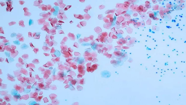 Mikroplastik vasitələrdən istifadə qadağan edildi