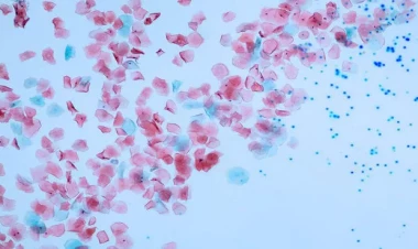 Mikroplastik vasitələrdən istifadə qadağan edildi