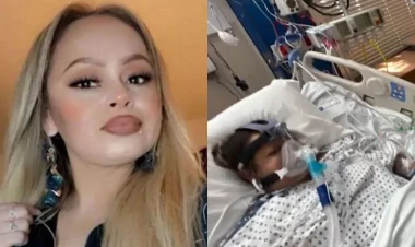 Xarab olmuş balıq yedi, əllərini və ayaqlarını itirdi