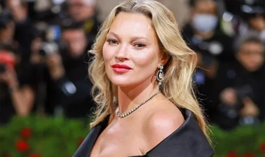 Məşhur supermodelin SON HALI sevənlərini qorxutdu - FOTO