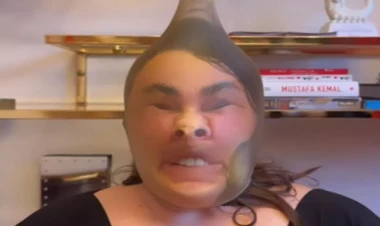 Üzünə corab keçirib estetik əməliyyat etdirənləri ələ saldı - VİDEO - FOTO