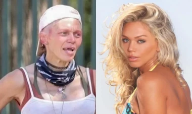 Bir zamanların ən gözəli üzündə yara izləri, dişləri tökülmüş halda görüntüləndi - FOTOLAR