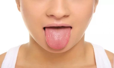 Dilimizi niyə təmizləməliyik?