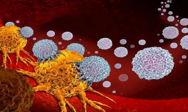 Gündə 5 dəqiqə yetər, xərçəng riskini AZALDIR