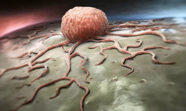 MÜJDƏ: 2026-da xərçəngə qarşı yeni dərmanlar... - FOTO