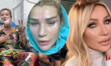 Seda Sayan yenidən estetik etdirdi - FOTOLAR