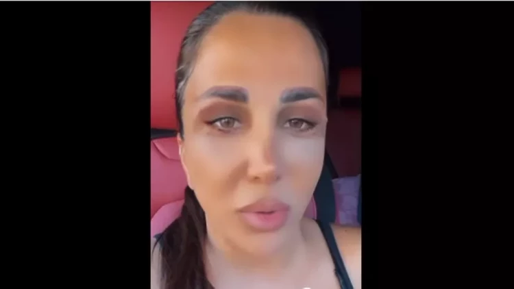 Azərbaycanlı məşhur müğənni gözəlləşmək üçün BUNU DA ETDİ - FOTO