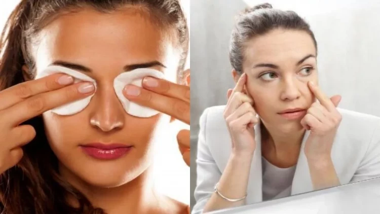 Gözaltı torbaları evdə də yox edə bilərsiniz