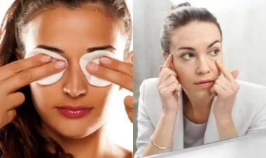 Gözaltı torbaları evdə də yox edə bilərsiniz