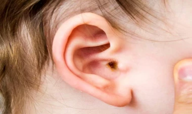 Uşaqlarınızda bu əlamətlər varsa, həkimə aparın - Yoxsa kar qala bilər