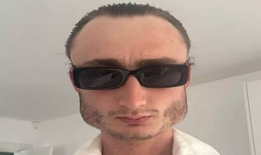 Boksdan üzü bu hala düşdü - FOTO