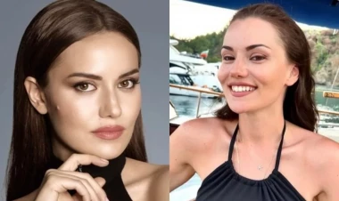 Fahriye göz qapaqlarını əməliyyat etdirib? - FOTO