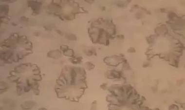 Dilarə Zəmzəm suyunu mikroskopla araşdırdı - Ortaya çıxan görüntü təəccübləndirdi - VİDEO