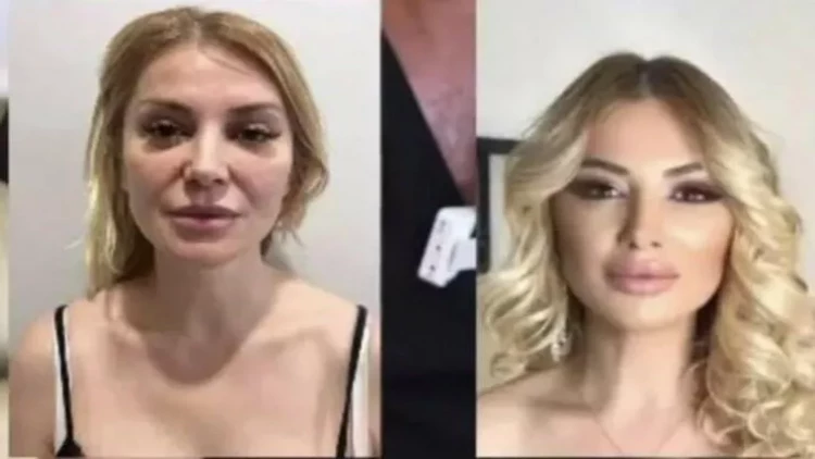 Məşhur aparıcını görənlər tanımadı - FOTO