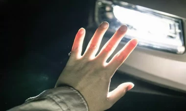 Bakıda gənc oğlanı avtomobil vurdu - VƏZİYYƏTİ AĞIRDIR