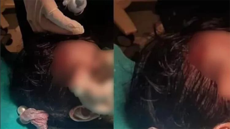 Mingəçevirdə azyaşlını skuter vurdu - FOTO