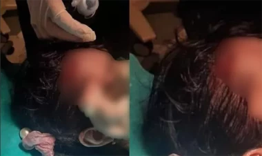 Mingəçevirdə azyaşlını skuter vurdu - FOTO