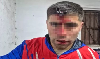 Açarla döydülər, alnında ilişib qaldı