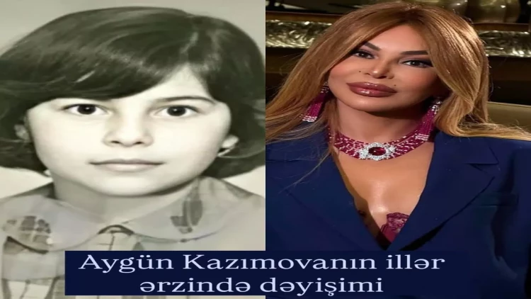 Aygün Kazımovanın illər ərzində dəyişimi - FOTO