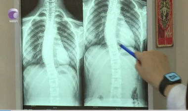 Son zamanlar “8-12” yaş arası uşaqlarda bel və boyun ağrılarının səbəbi