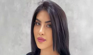 Pilinq reklamı faciəyə çevrildi: Tiktoker Ləmanın üzündə yanıq yarandı