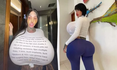 Görünüşünü tamamilə dəyişdirən qalmaqalı blogger ölü TAPILDI - FOTO