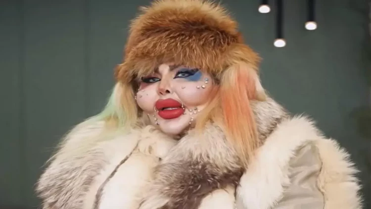 İranlı bloqer estetik əməliyyatlarına görə rekord qırdı