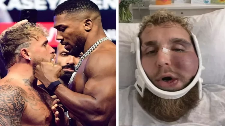 Çənəsi sındı, amma 92 milyon dollar qazandı - FOTO