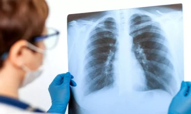 Məktəblilər arasında pnevmoniya sürətlə yayılır - XƏBƏRDARLIQ