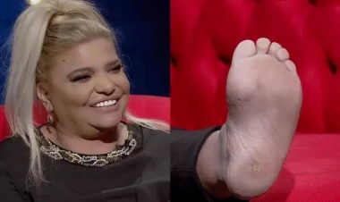 Kibariyənin ayağı sosial mediada gündəm oldu